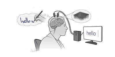 Yeni beyin implantı felçli adamın düşüncelerini yüzde 94 doğruluk payıyla yazıya döktü